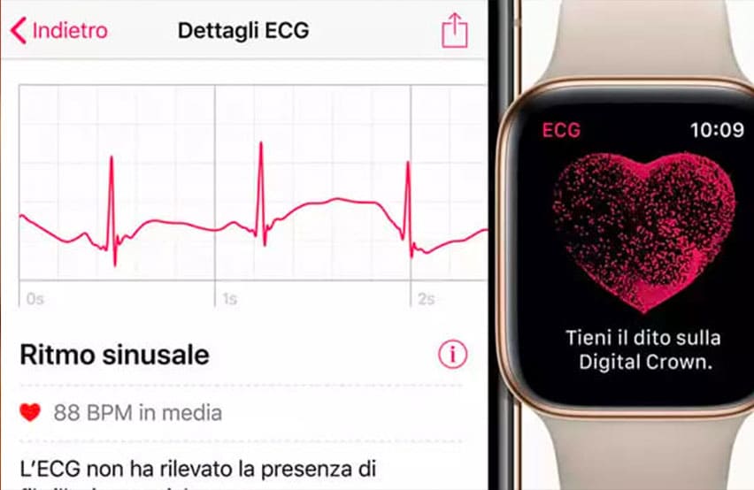 apple watch ecg simone ventra